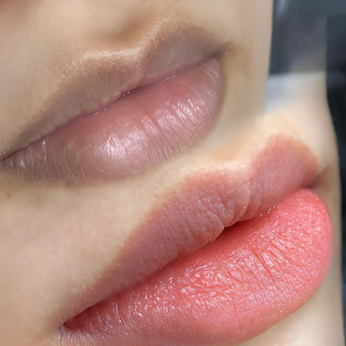 How to Lighten Dark Lips Effectively: A Dermatologist’s Guide